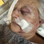 A LA POLICÍA NO LE CIERRA LA HIPÓTESIS DEL ROBO EN EL CASO DE LA MUJER SALVAJEMENTE GOLPEADA