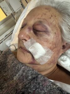 A LA POLICÍA NO LE CIERRA LA HIPÓTESIS DEL ROBO EN EL CASO DE LA MUJER SALVAJEMENTE GOLPEADA